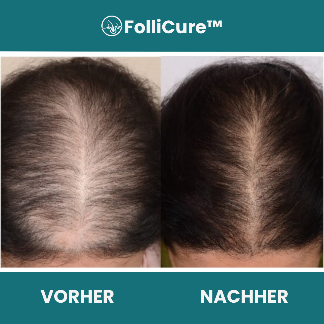 FolliCure™ Anti-Haarausfall-Shampoo