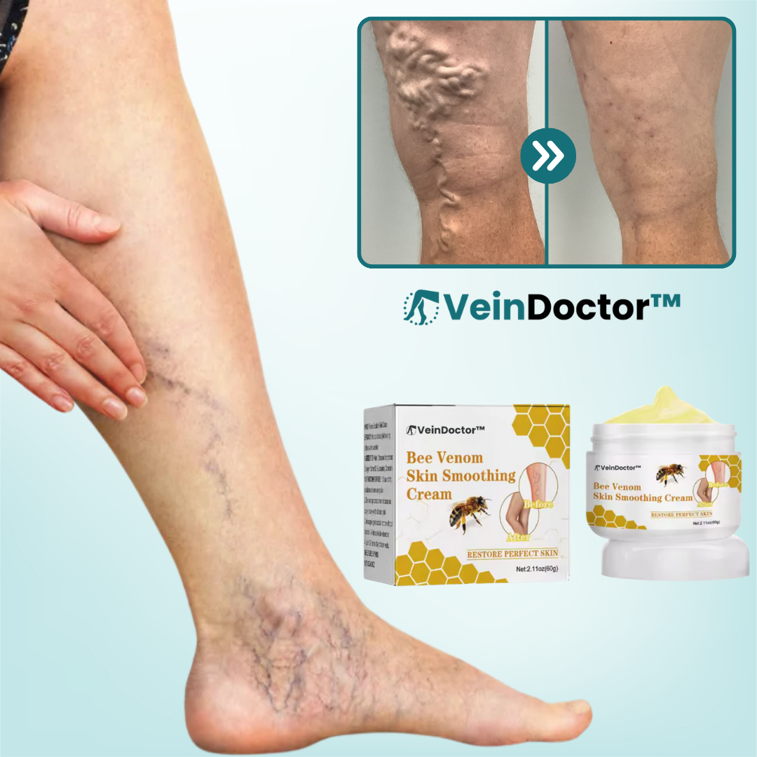 VeinDoctor™ Anti-Krampfader-Creme